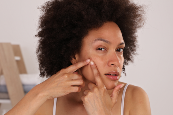 How to treat spots & blemishes
