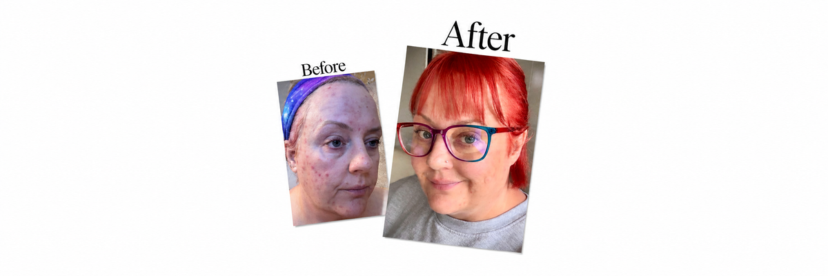Lisa's Before and After