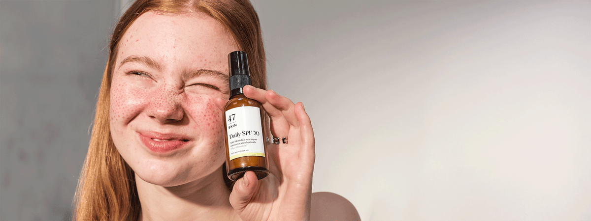 SPF for Blemish-Prone Skin: Why It Matters More Than You Think