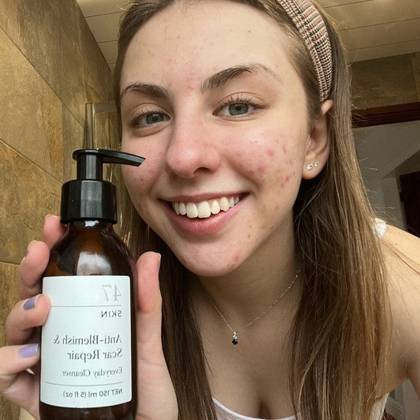 Meet Liv: "Not comparing yourself to others is a mindset"