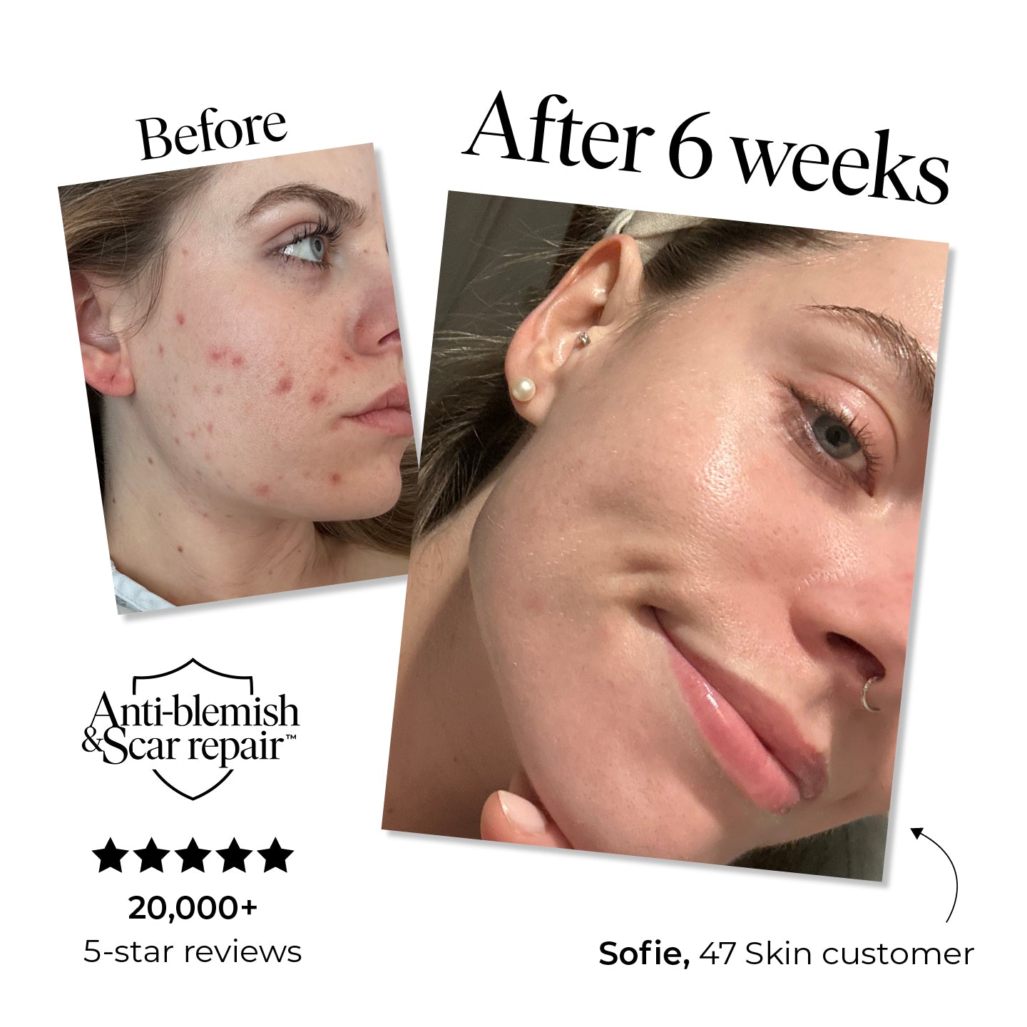 3 Step Moisture Bundle