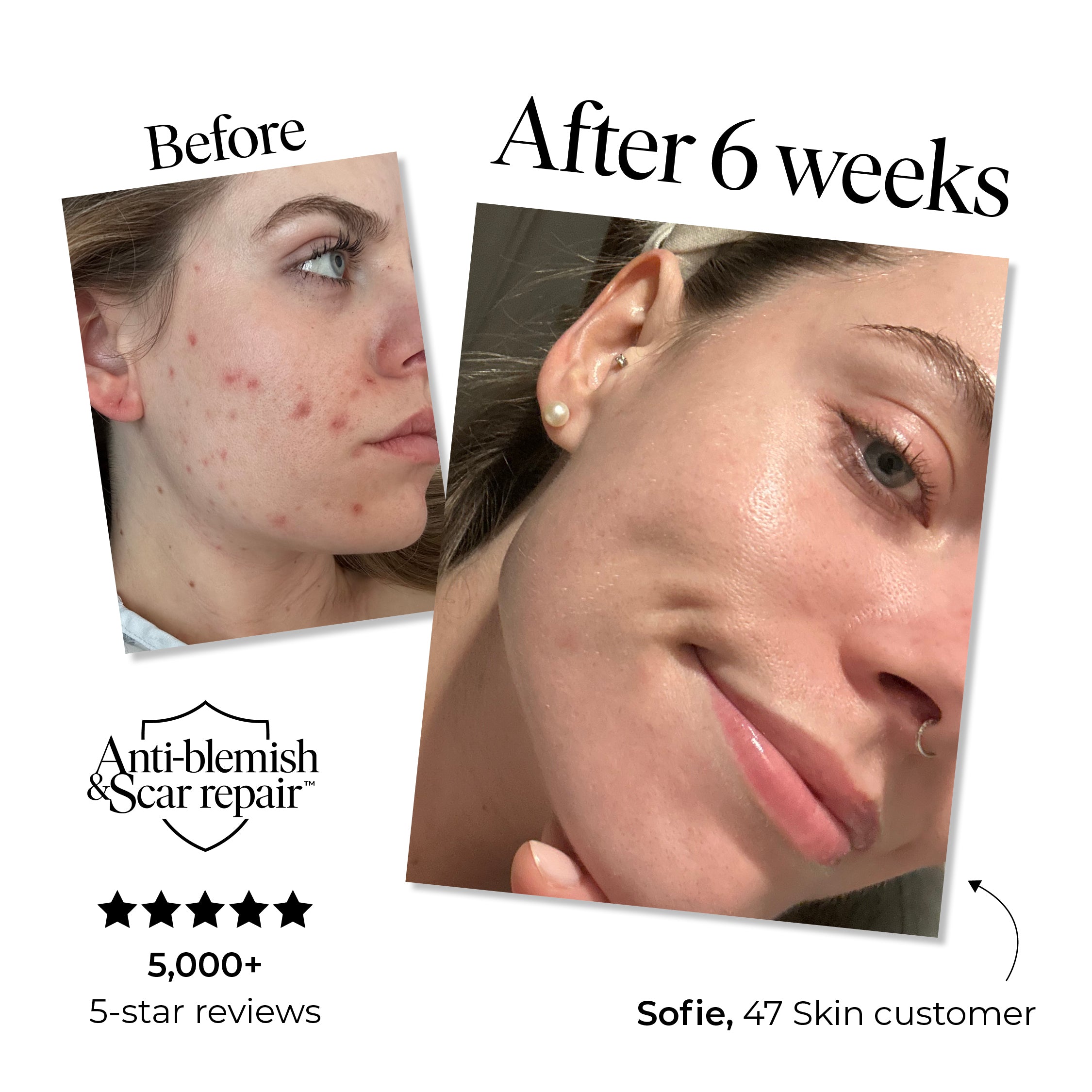 3 Step Moisture Bundle