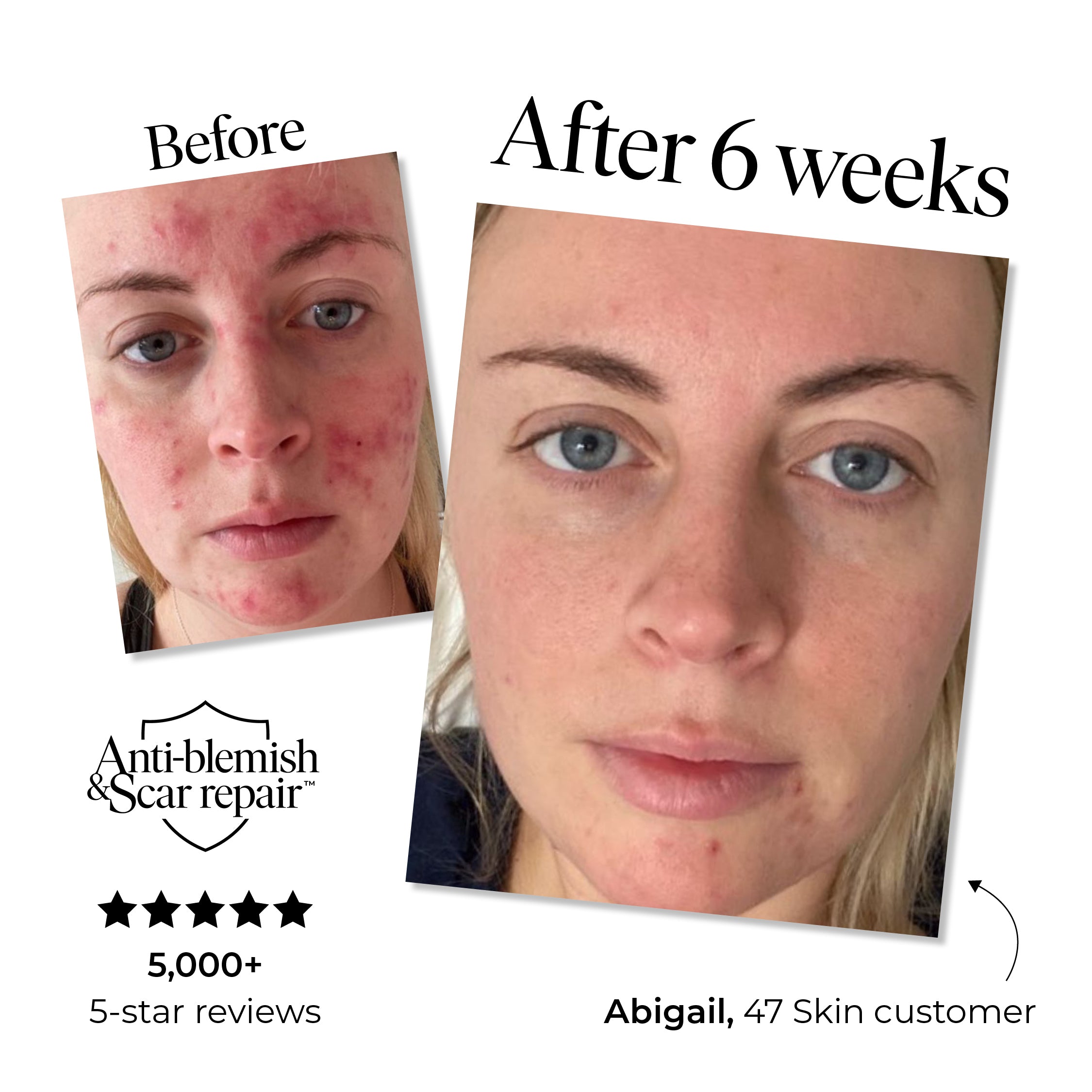 4 Step Skin Repair Bundle