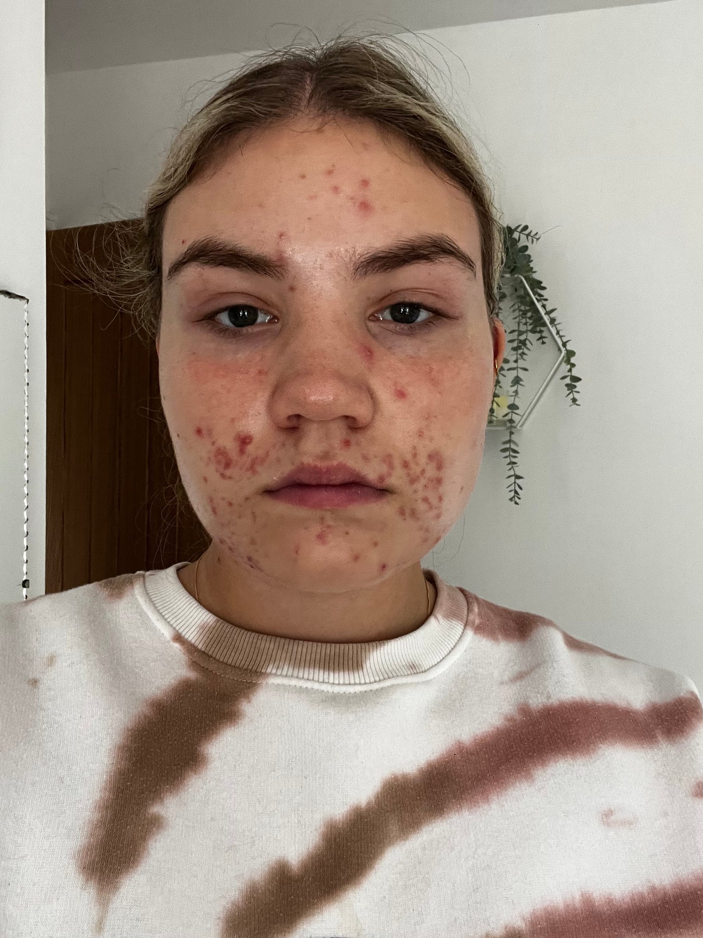Aimee_Hudson_before_Picture_-_1.jpg