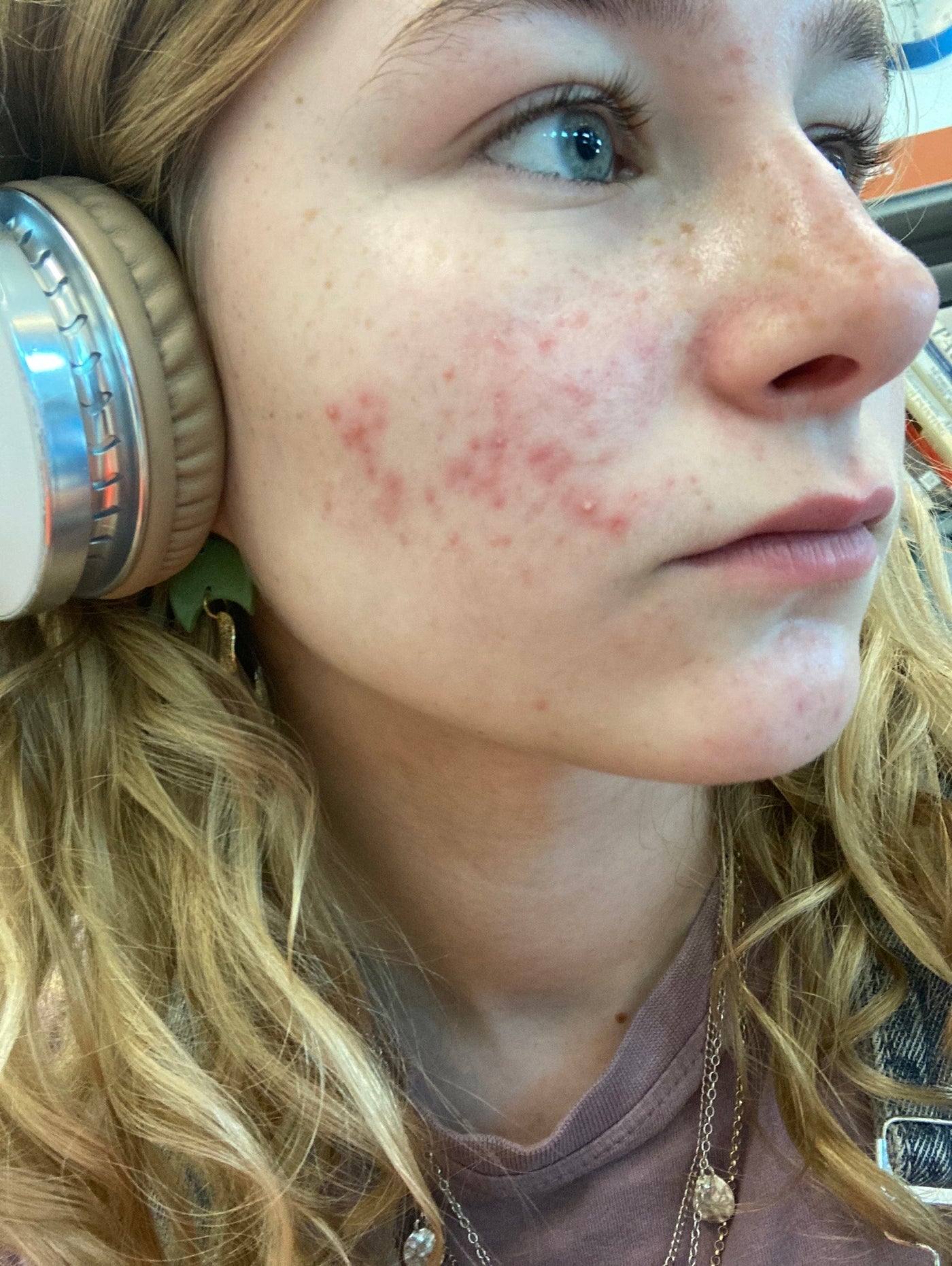 Annabel_Mackenney_before_picture_0d3c62f5-0d7c-43a3-a858-fba4173d5cc5.jpg