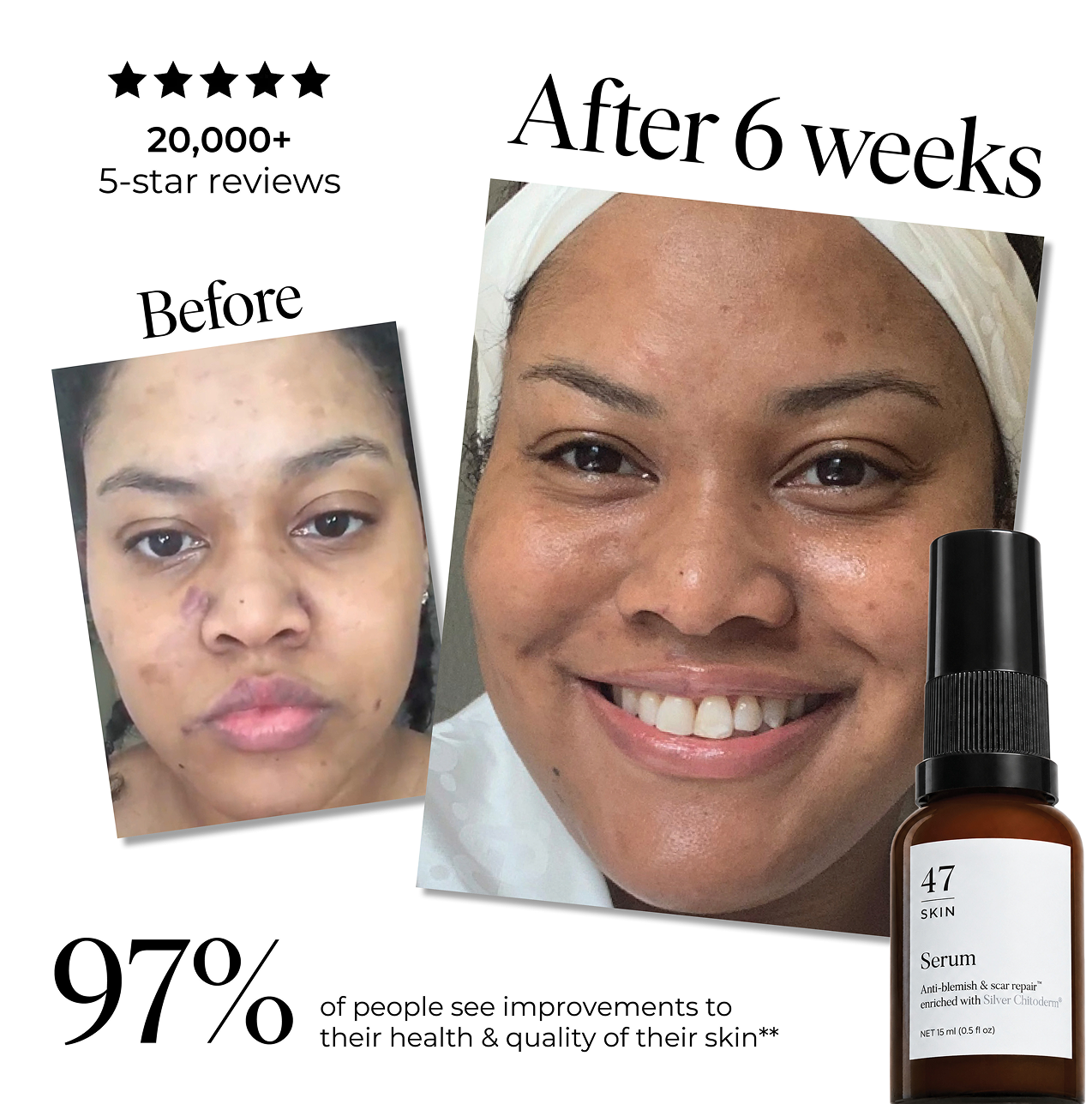 Your skin changed. Here’s the clinically proven solution to help.