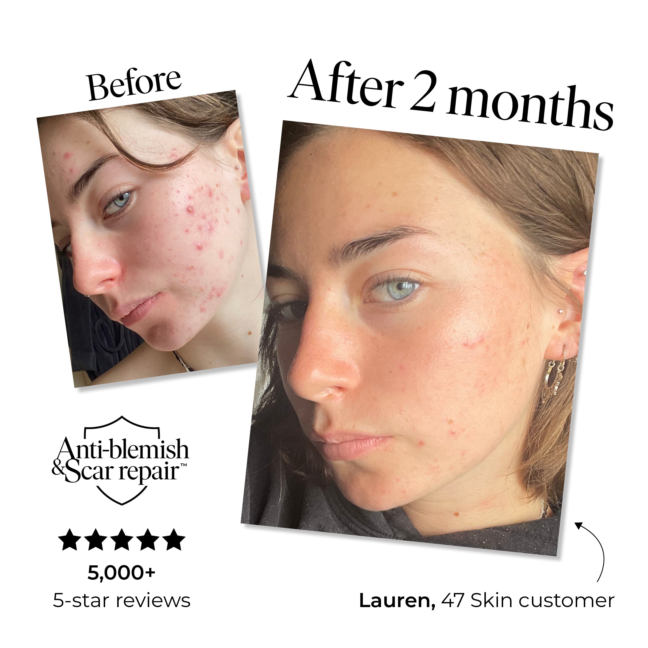 Daily SPF 30, enriched with Silver Chitoderm®