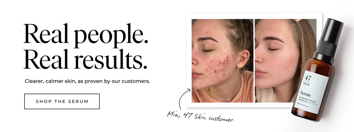 Real People Real Results
