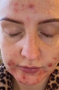 Ellie_Oaks_before_picture_-_front_facing.jpg