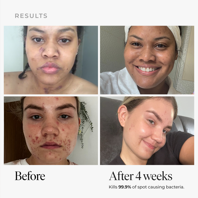 Anti-blemish & scar repair Serum