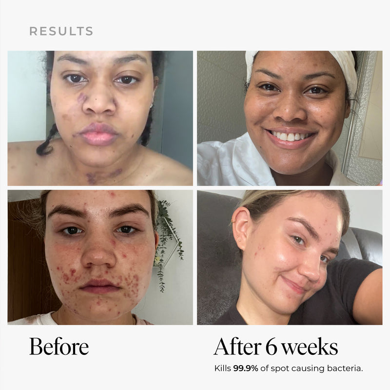 #1 Best Seller: Anti-Blemish & Scar Repair Serum