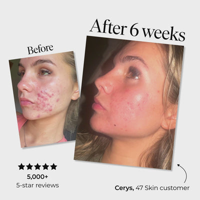 2 Step Cleanse & Protect Bundle