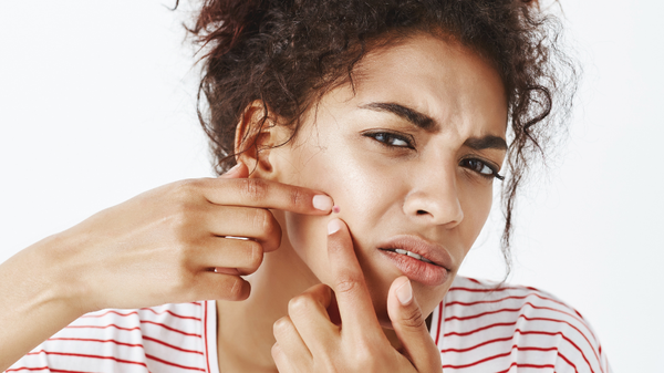 Are you a spot squeezing addict?