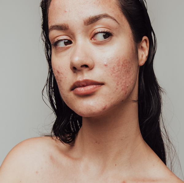 How To Calm Your Inner Skin Critic