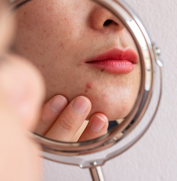 The fastest way to reduce a spot