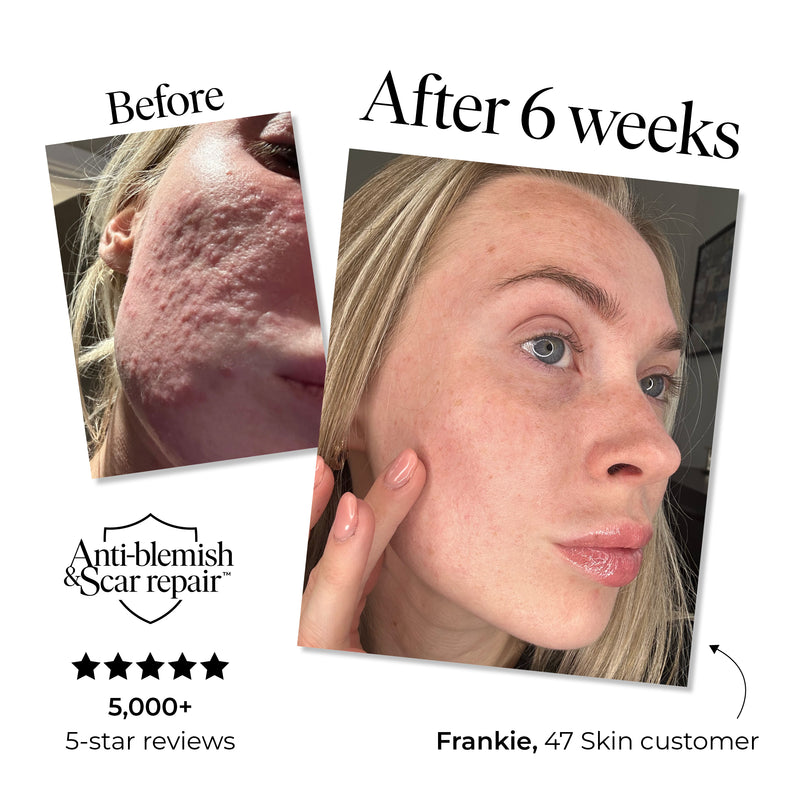 5 Step Sun-Proof Bundle