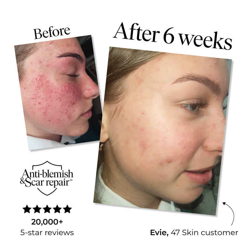 47 Skin BHA Salicylic Acid Exfoliant