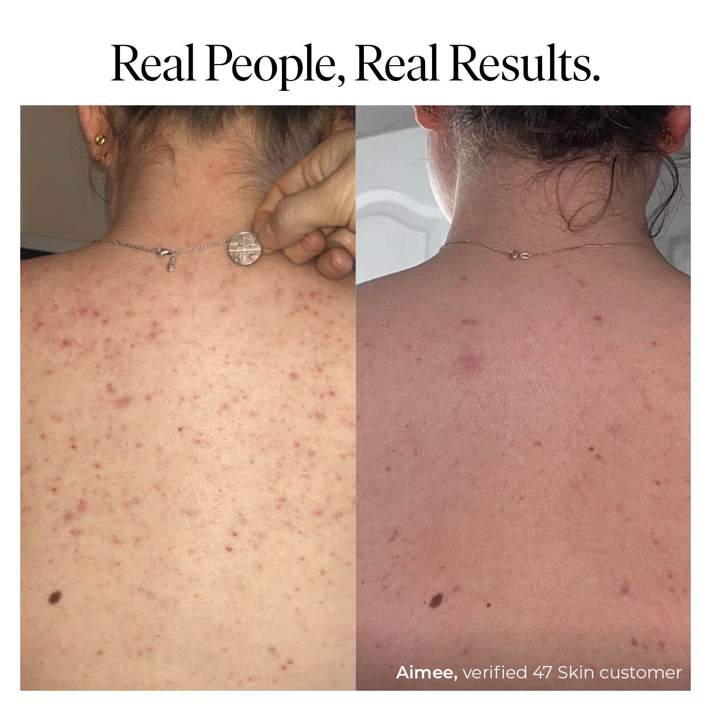 Treatment Body Wash