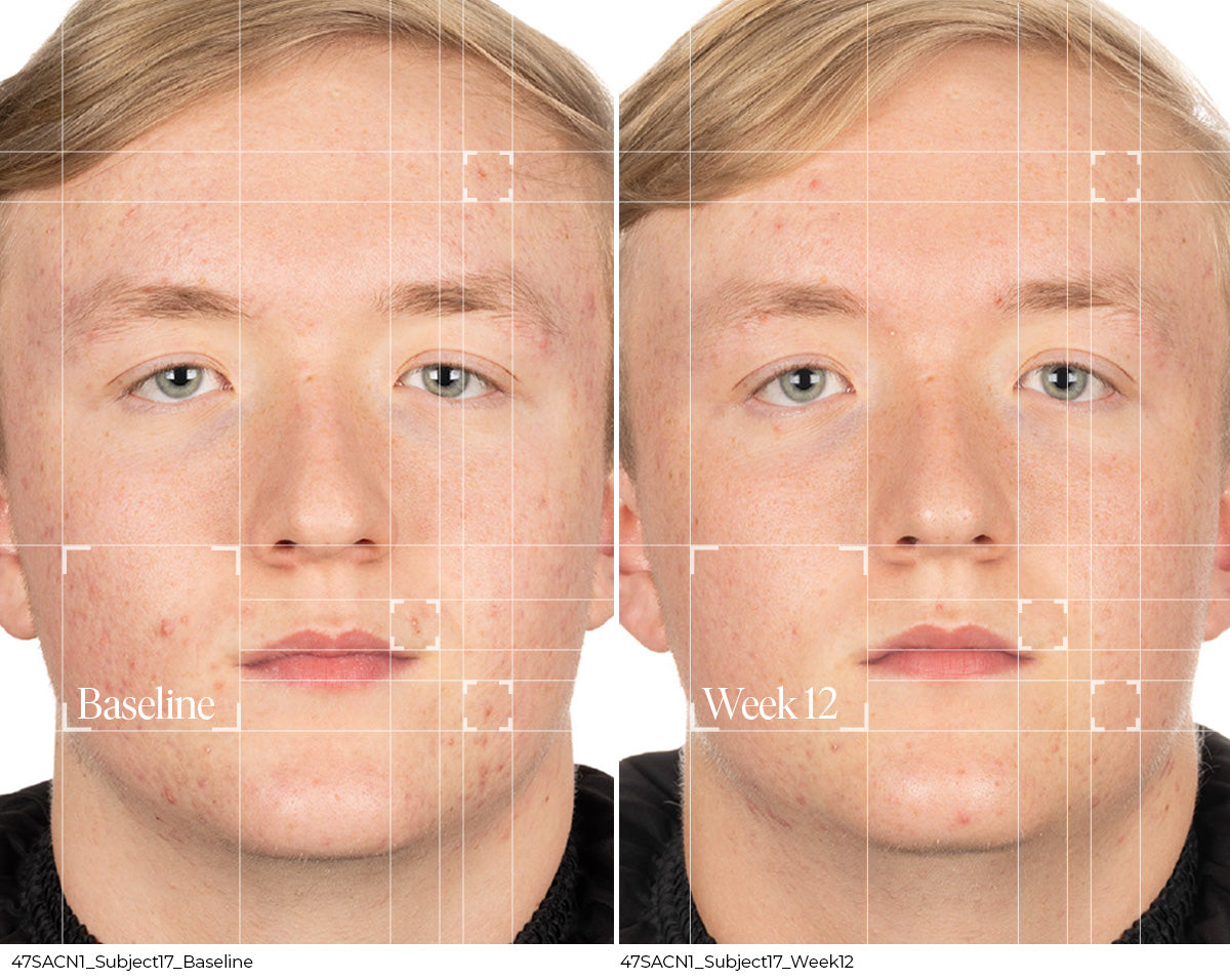 Before and Week 12 clinical result