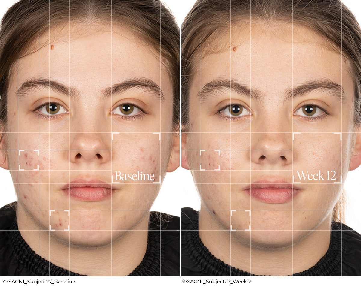 Before and Week 12 clinical result