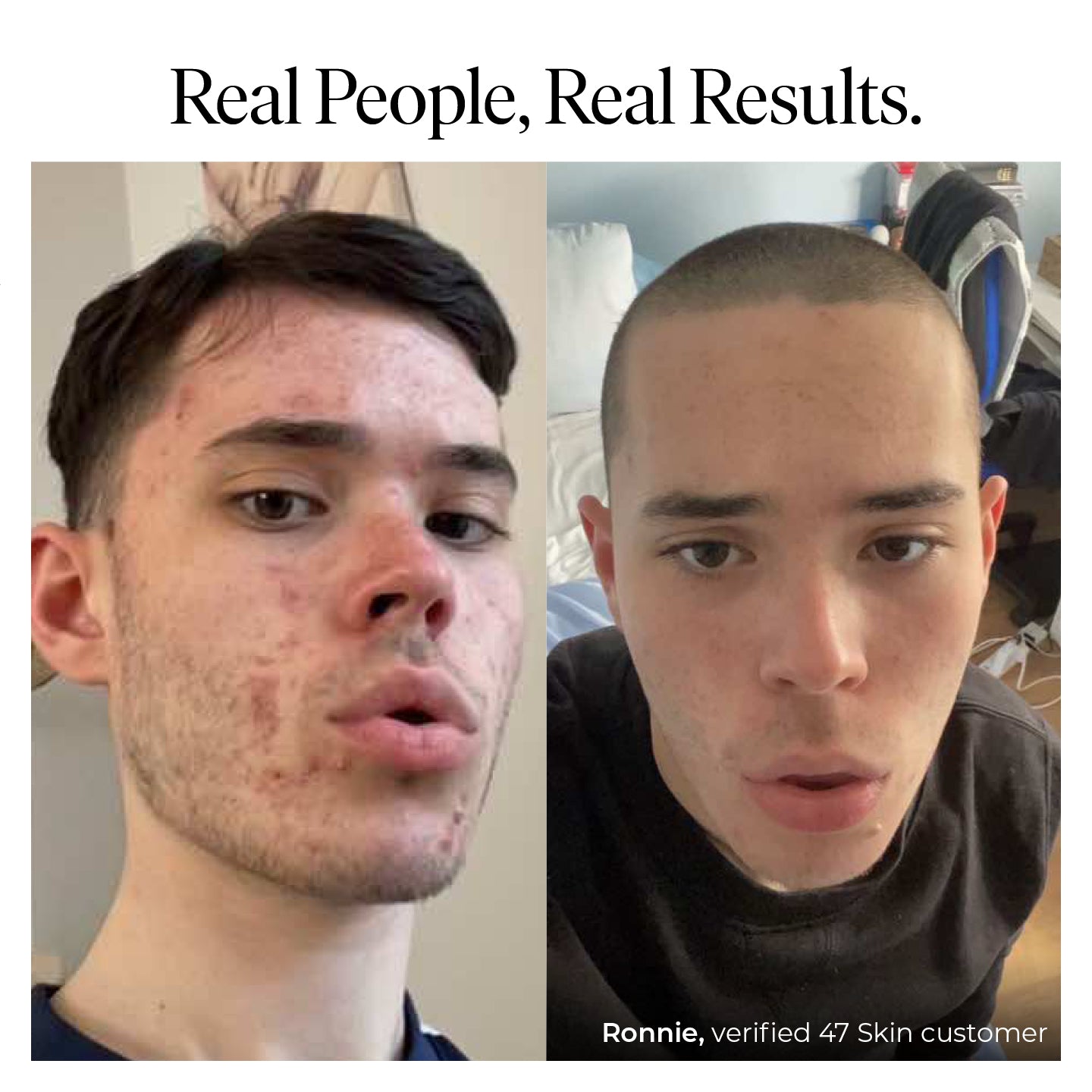 Anti-Blemish & Scar Repair Blue Clay Mask