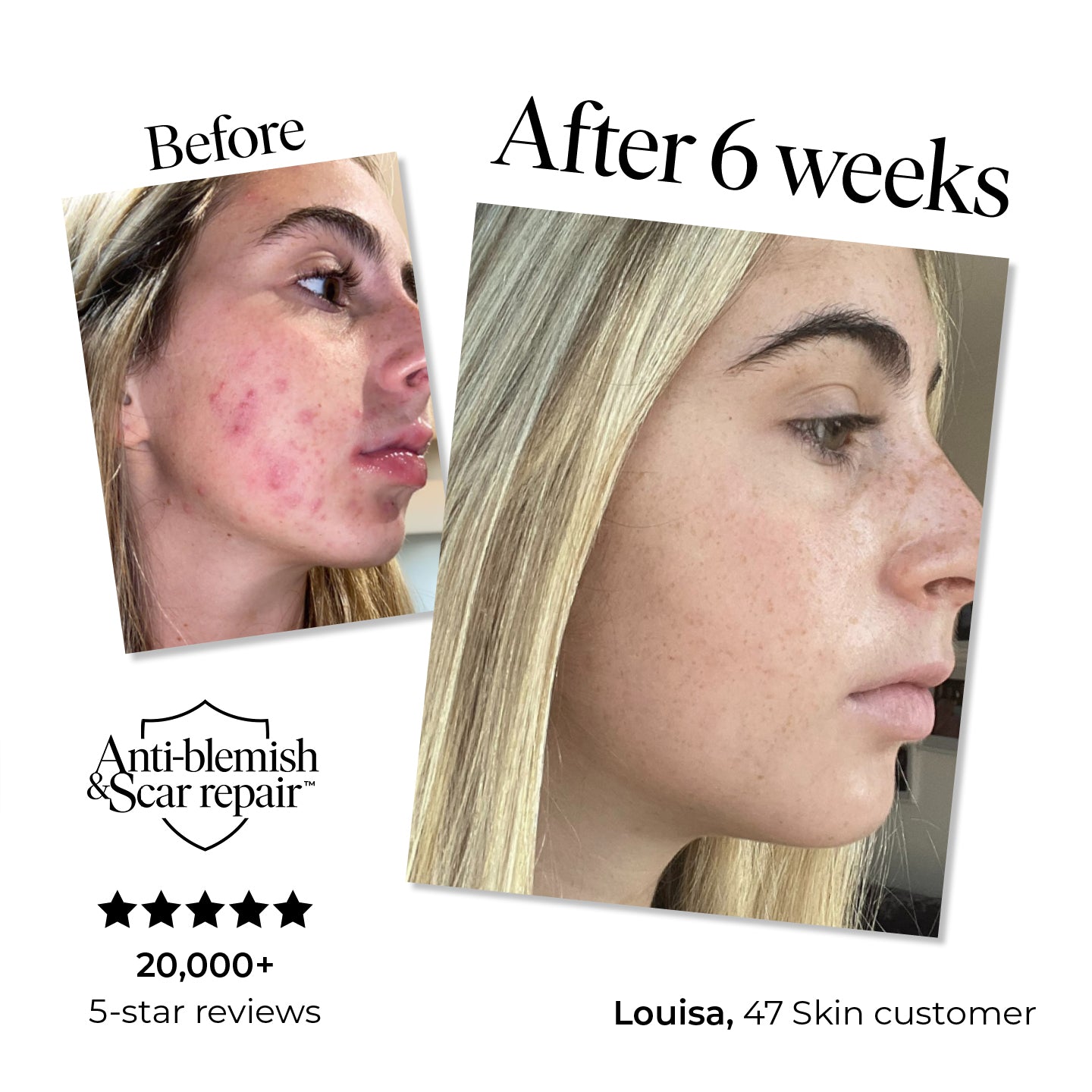 Anti-Blemish & Scar Repair Blue Clay Mask