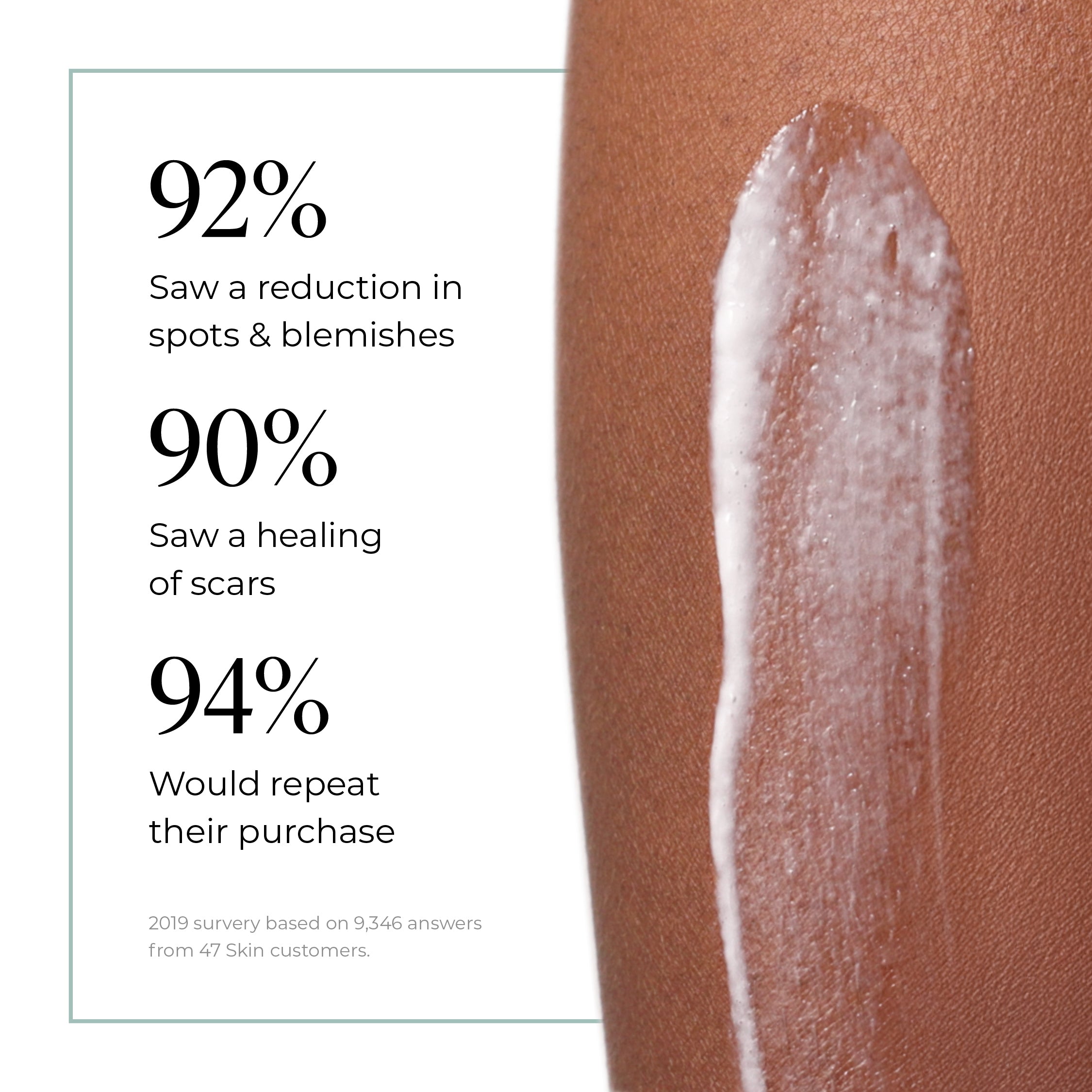 Trial Size Anti-Blemish & Scar Repair Body Moisturiser (10ml)