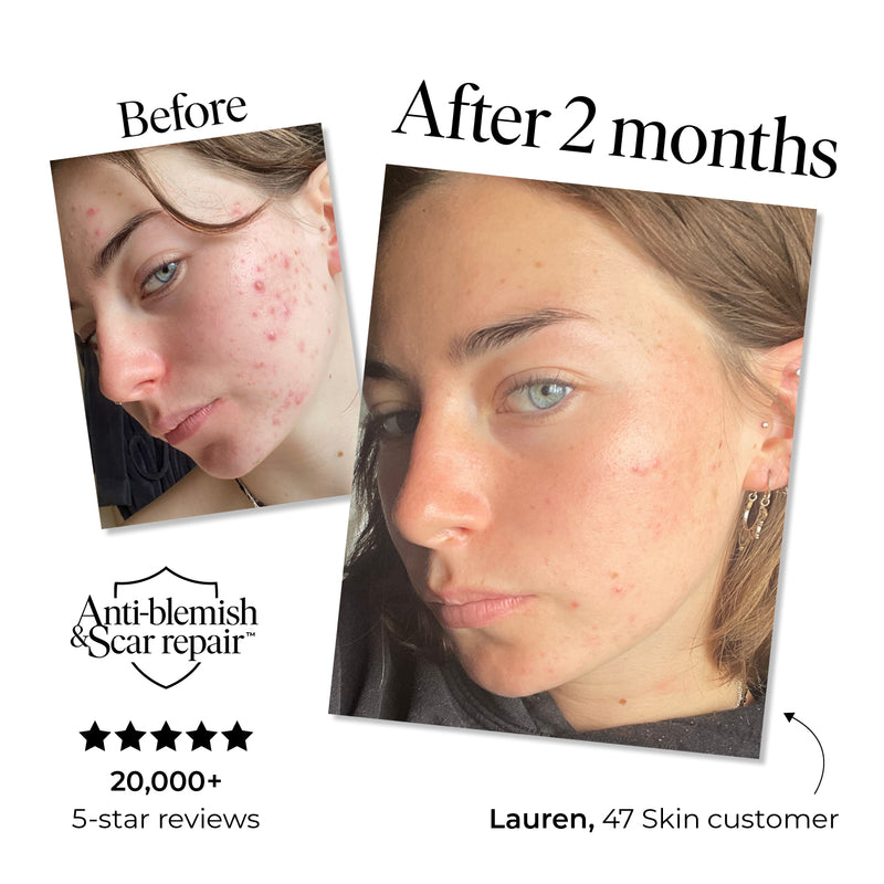 Daily SPF 30, enriched with Silver Chitoderm®