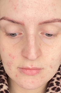 Ellie_Oaks_after_image_-_front_facing.jpg