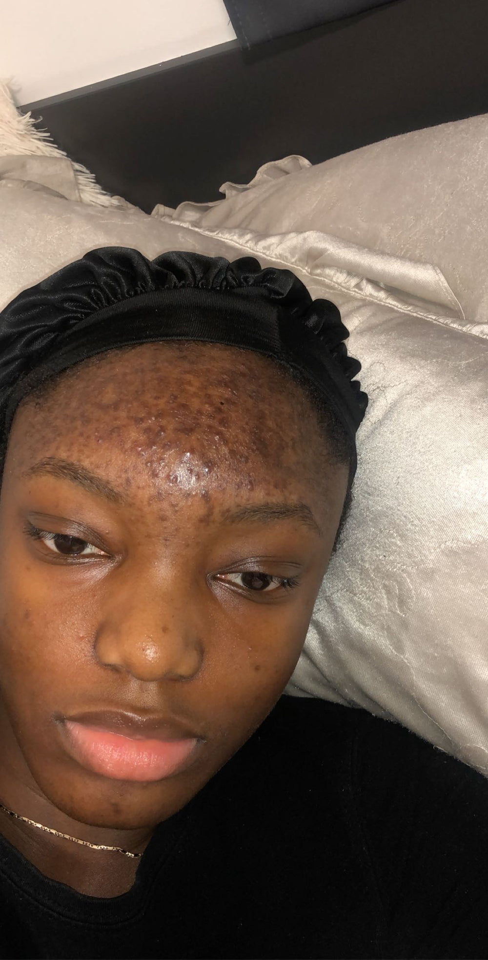 Esther_before_image.jpg