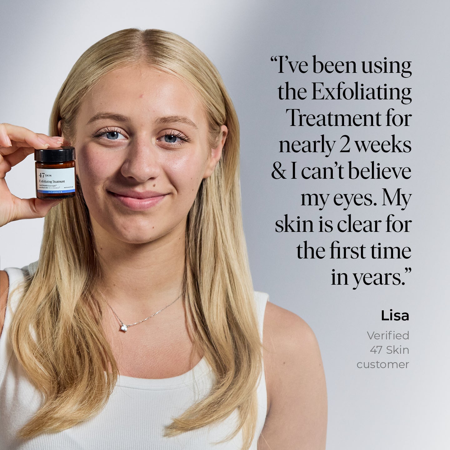 Exfoliating Skin Treatment for persistent, stubborn and cystic blemishes