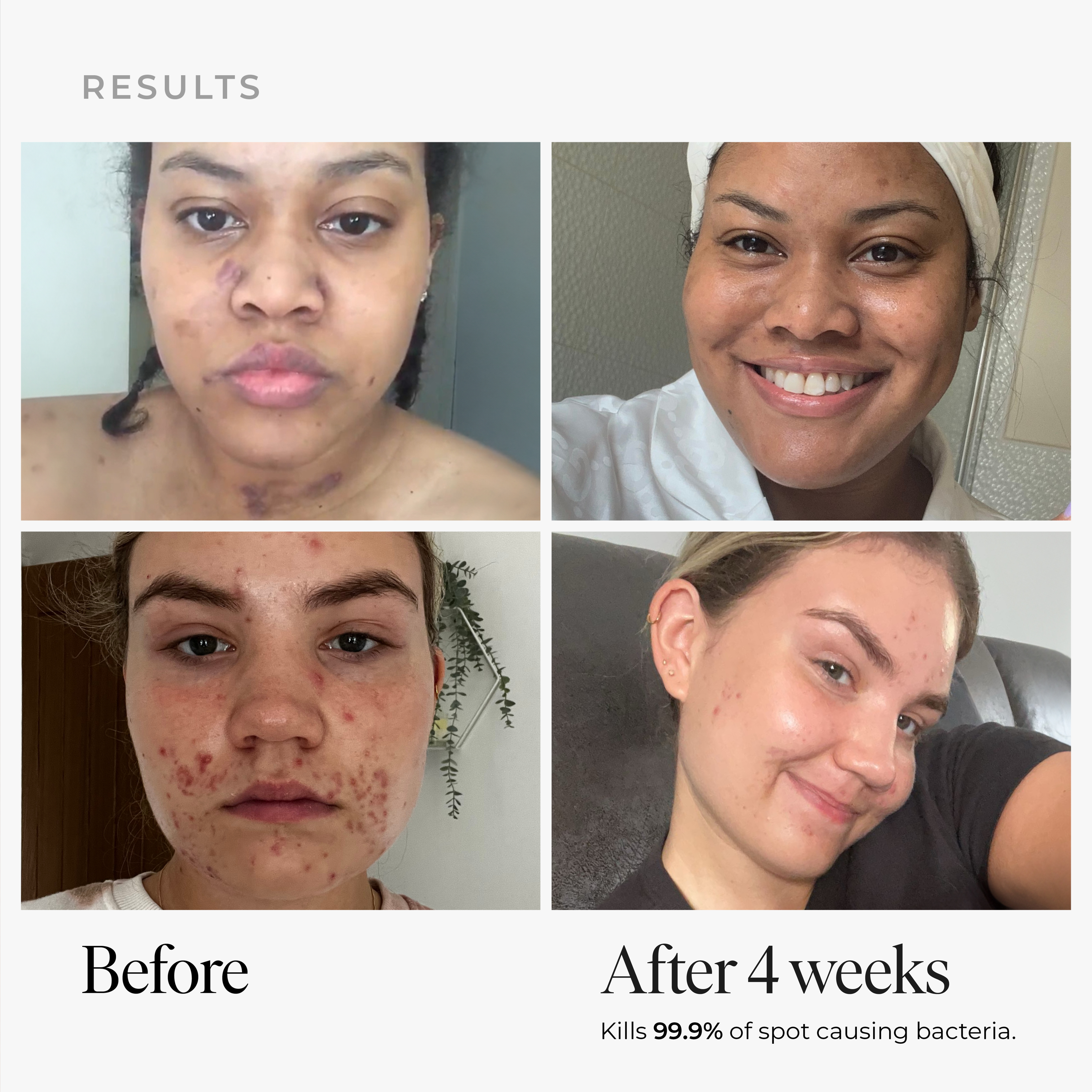 Anti-blemish & scar repair Serum