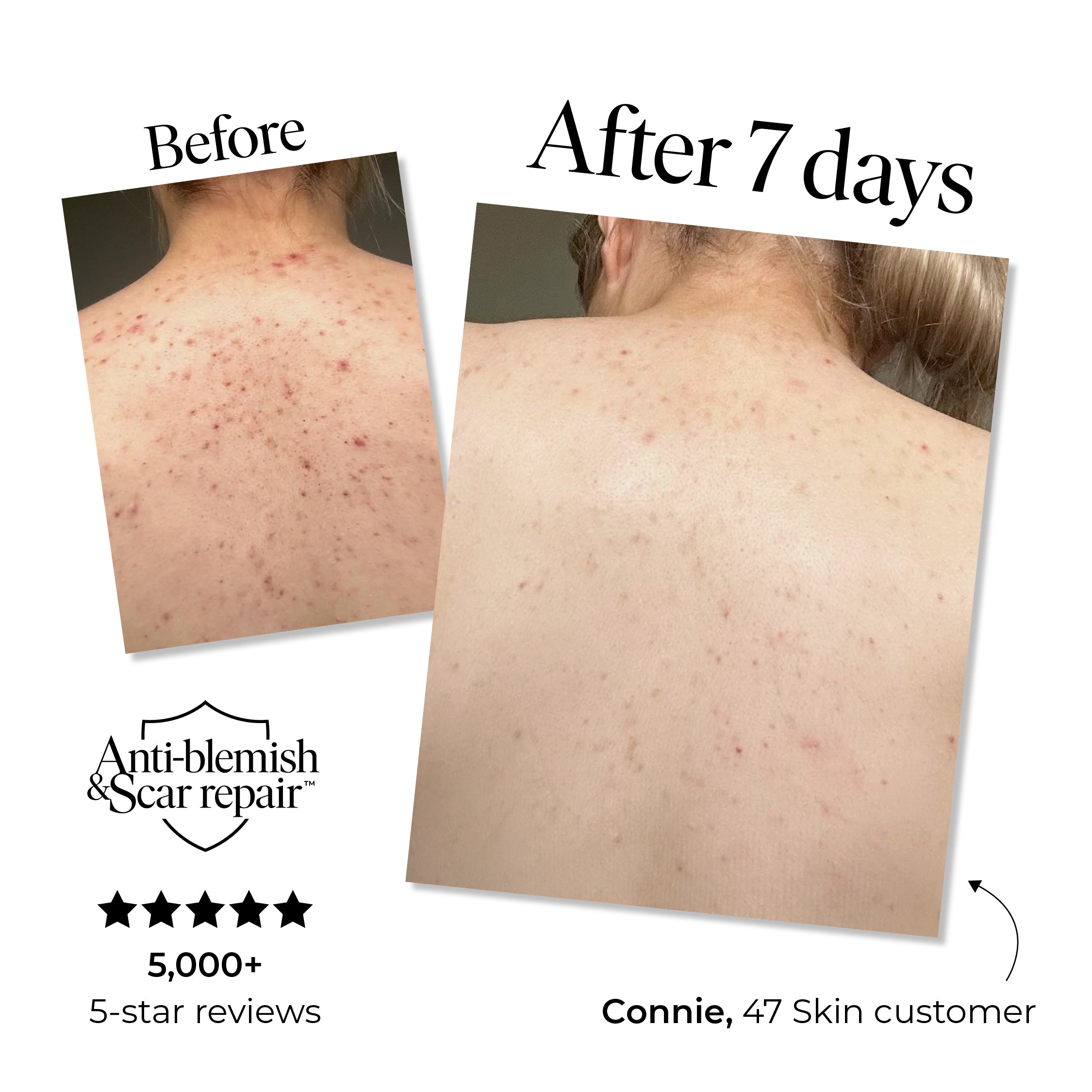 Treatment Body Wash