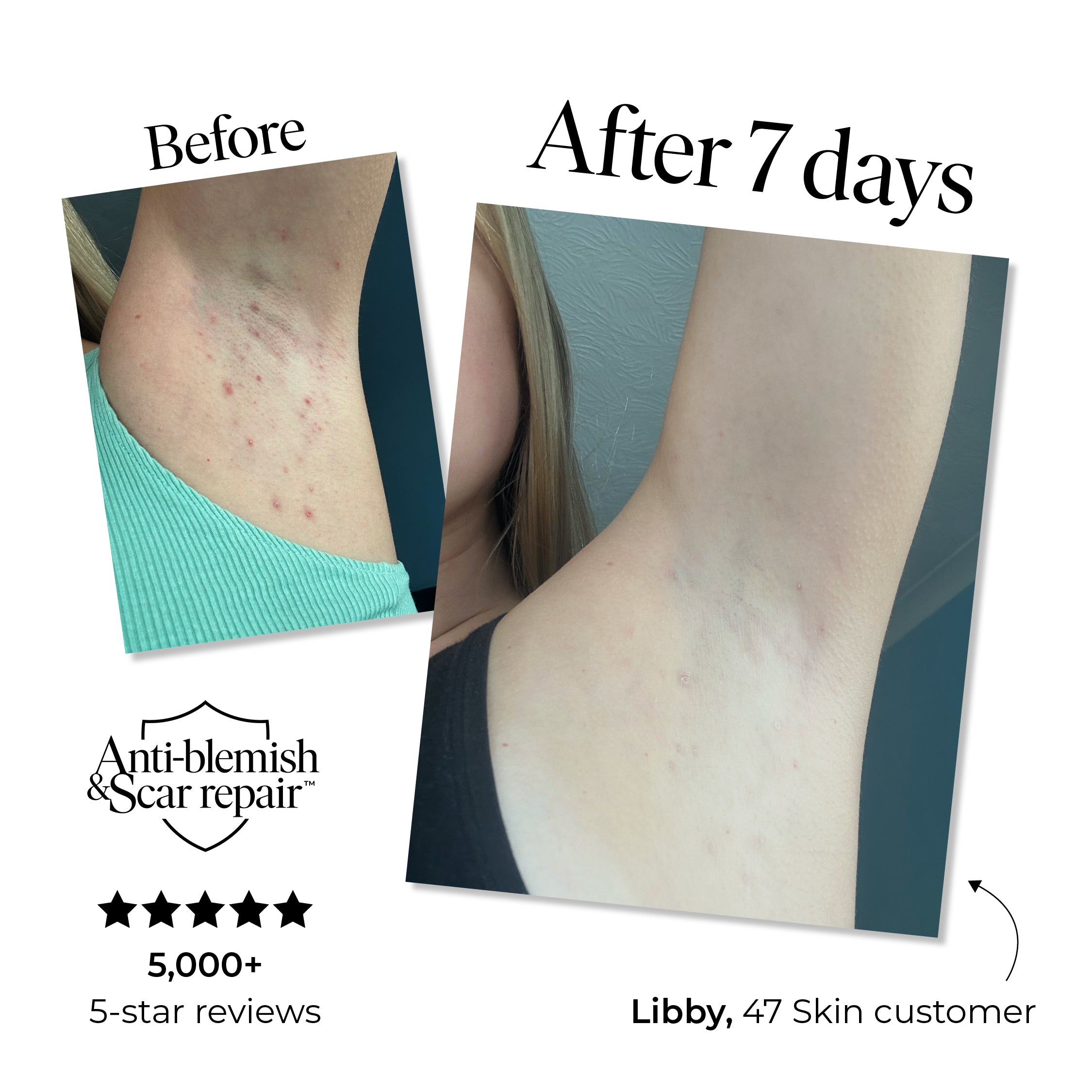 Treatment Body Wash