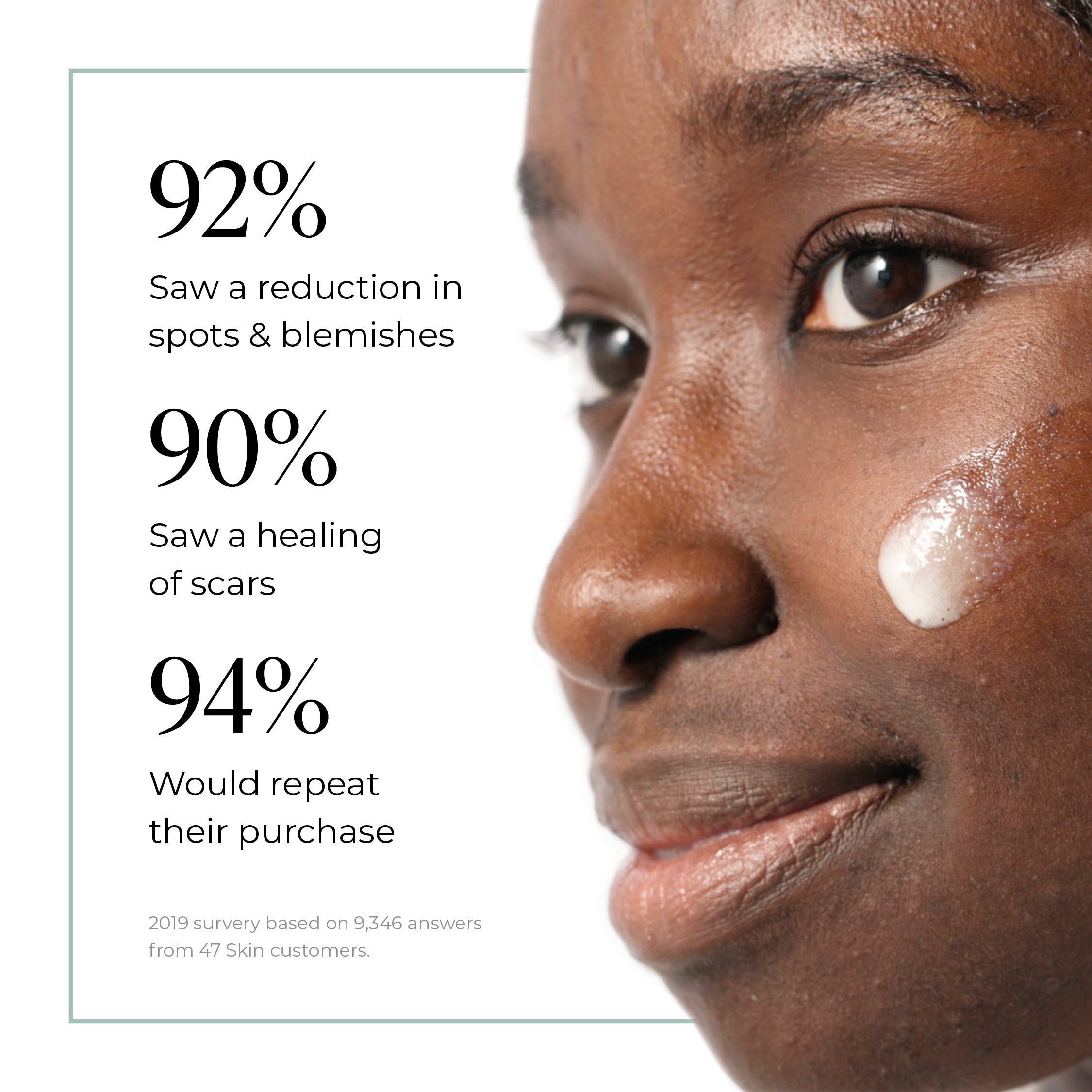 Treatment Serum for persistent, stubborn and cystic blemishes