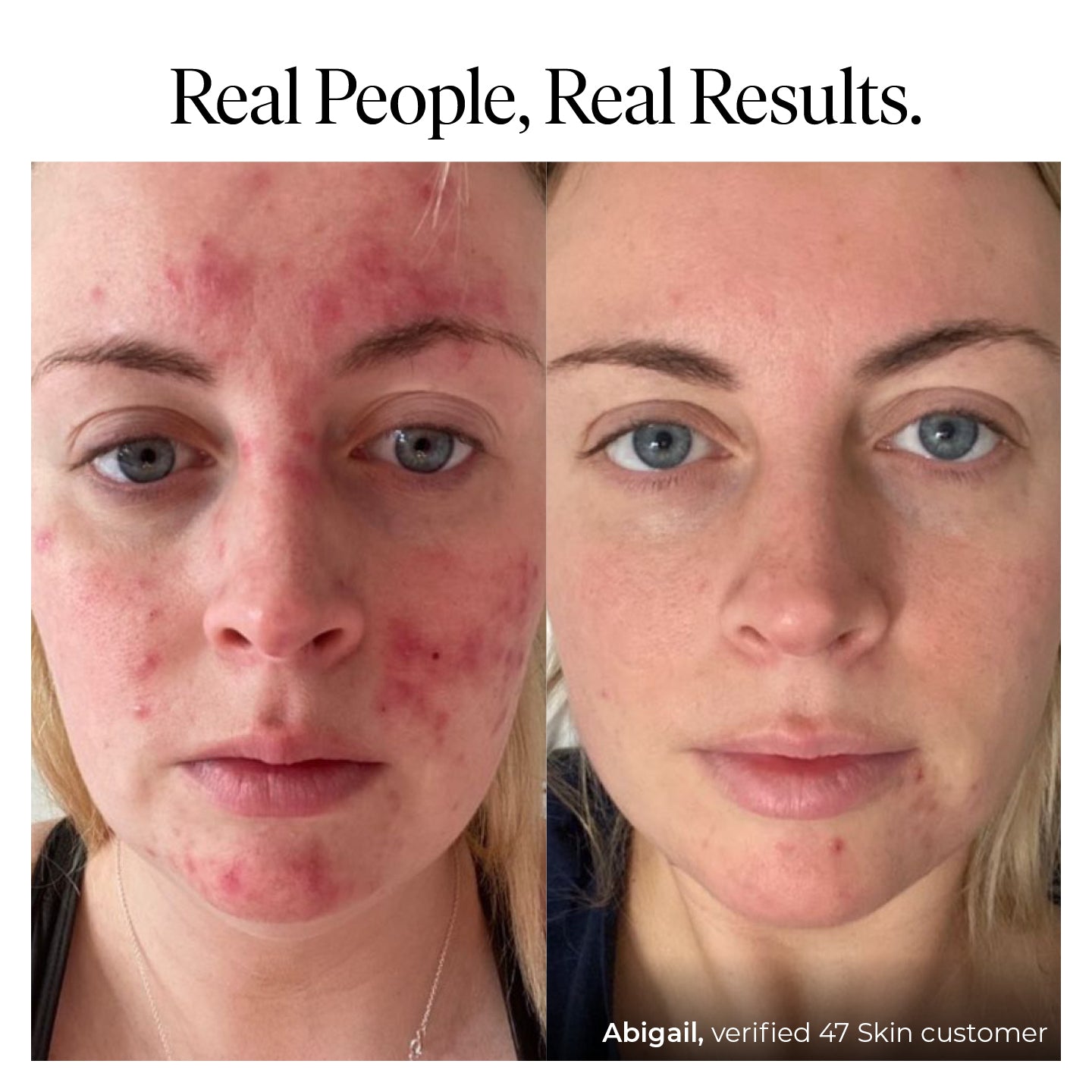3 Step Treatment Bundle